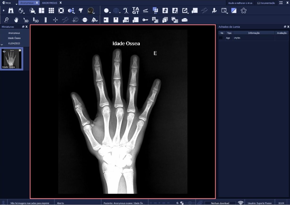 radiologia e diagnóstico por imagem, Inteligência Artificial no Diagnóstico por Imagem: como a IA auxilia os radiologistas?