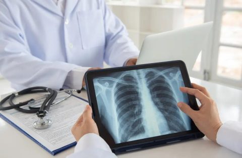 Radiología digital, Inteligencia Artificial en la Salud: Ejemplos de IA para radiología